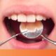 Tips Mengatasi Rasa Tidak Nyaman Setelah Pencabutan Gigi