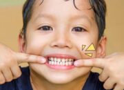 Cara Menjaga Gigi Tetap Bersih Di Pergantian Gigi Anak-anak