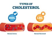 Jenis Kolesterol: HDL, LDL, Dan Trigliserida