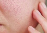 Panduan Mengecilkan Pori-pori Dengan Skincare Yang Tepat
