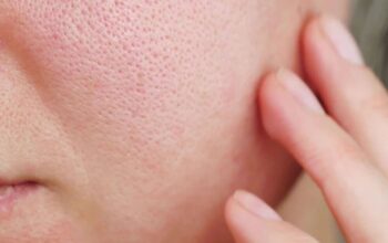 Panduan Mengecilkan Pori-pori Dengan Skincare Yang Tepat