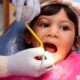 Mitos Dan Fakta Tentang Pemutihan Gigi