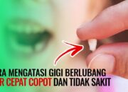 Cara Mencegah Dan Mengatasi Gigi Berlubang