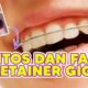 Mitos Dan Fakta Tentang Penyakit Akar Gigi